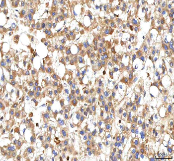 BCAT2 Antibody