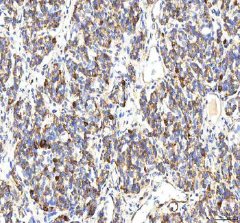 BCAT2 Antibody