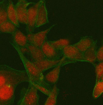 PATZ1 Rabbit Polyclonal Antibody