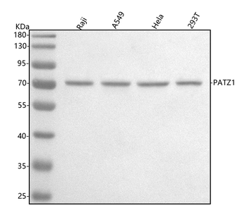 PATZ1 Rabbit Polyclonal Antibody