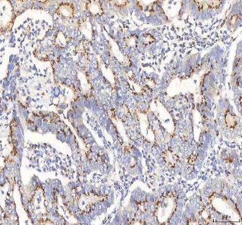 BPNT2 Antibody