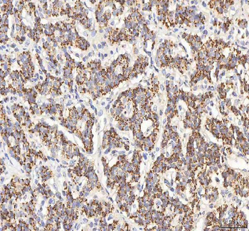 BPNT2 Antibody