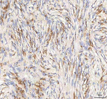 BPNT2 Antibody