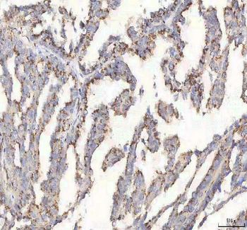 BPNT2 Antibody