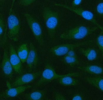 PELI2 Rabbit Polyclonal Antibody