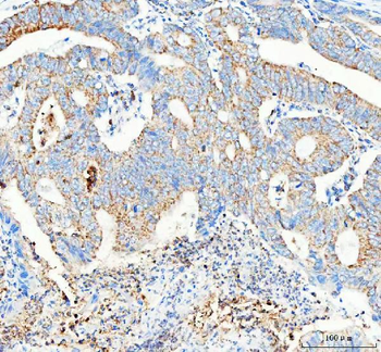 PELI2 Rabbit Polyclonal Antibody