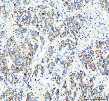 PELI2 Rabbit Polyclonal Antibody