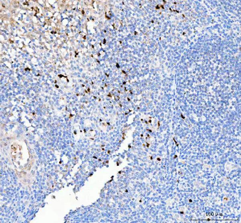 PELI2 Rabbit Polyclonal Antibody