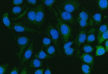 Pyruvate Carboxylase/PC Antibody
