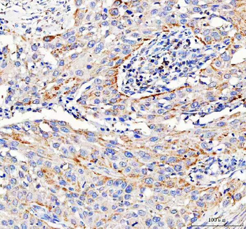 Pyruvate Carboxylase/PC Antibody