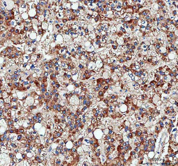 Pyruvate Carboxylase/PC Antibody