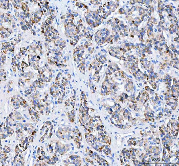 Pyruvate Carboxylase/PC Antibody