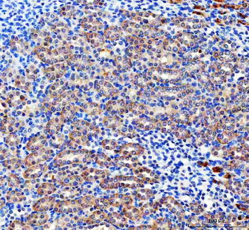 Pyruvate Carboxylase/PC Antibody