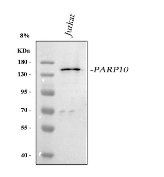 PARP10 Rabbit Polyclonal Antibody