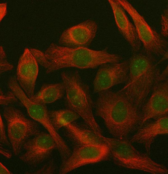 PARP3 Rabbit Polyclonal Antibody