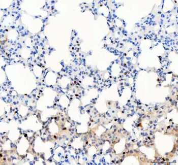 PARP3 Rabbit Polyclonal Antibody