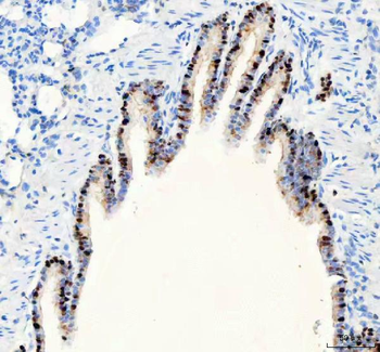 PARP3 Rabbit Polyclonal Antibody