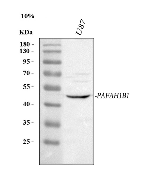 LIS1/PAFAH1B1 Rabbit Polyclonal Antibody