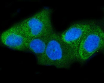 INSIG1 Rabbit Polyclonal Antibody