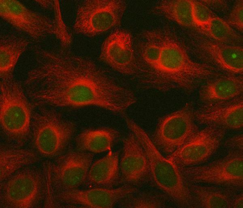 ING2 Rabbit Polyclonal Antibody