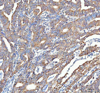 ATG7 Antibody