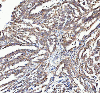 ATG7 Antibody