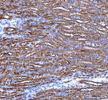 PARD6B Rabbit Polyclonal Antibody