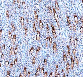 PARD6B Rabbit Polyclonal Antibody