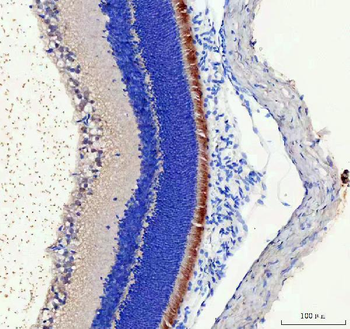 IMPG2 Rabbit Polyclonal Antibody