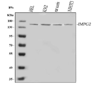 IMPG2 Rabbit Polyclonal Antibody