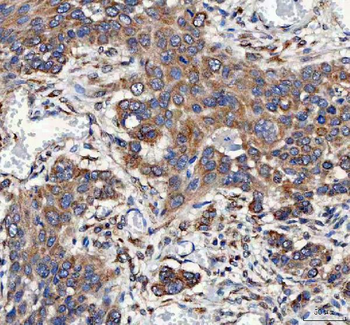 Mitofilin/IMMT Rabbit Polyclonal Antibody