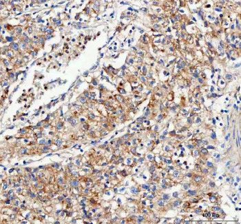 Mitofilin/IMMT Rabbit Polyclonal Antibody