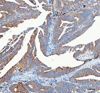 Mitofilin/IMMT Rabbit Polyclonal Antibody
