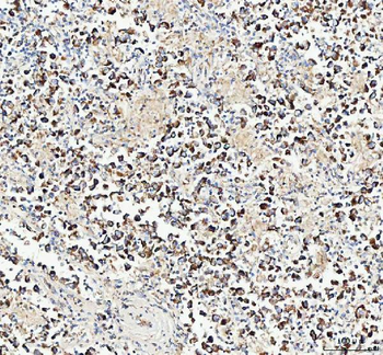 Mitofilin/IMMT Rabbit Polyclonal Antibody