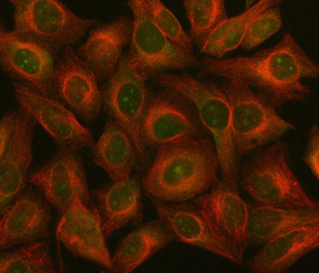 NF45/ILF2 Antibody