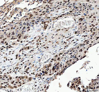 NF45/ILF2 Antibody