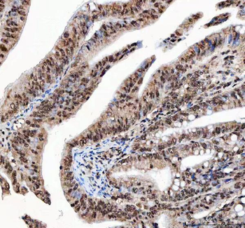 NF45/ILF2 Antibody