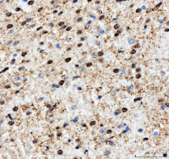 NF45/ILF2 Antibody