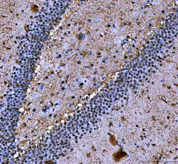 NF45/ILF2 Antibody