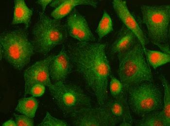 IFFO1 Rabbit Polyclonal Antibody