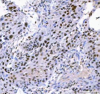 IFFO1 Rabbit Polyclonal Antibody