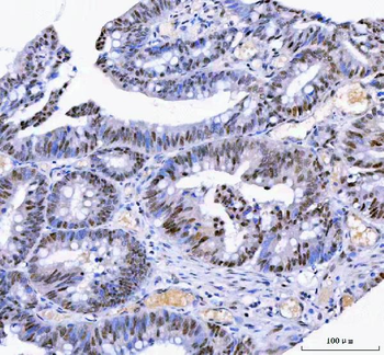 IFFO1 Rabbit Polyclonal Antibody