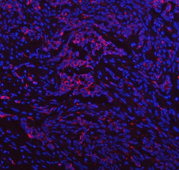 IDUA Antibody