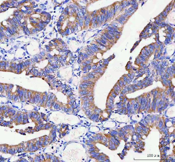 IDUA Antibody
