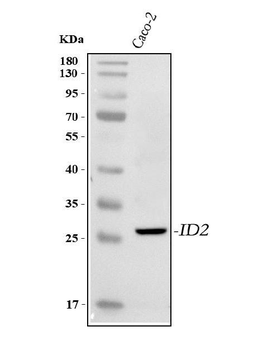 IDI2 Rabbit Polyclonal Antibody