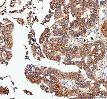 IDI1 Rabbit Polyclonal Antibody