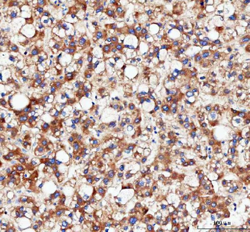 IDH3G Antibody