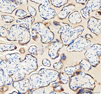 IDH3G Antibody