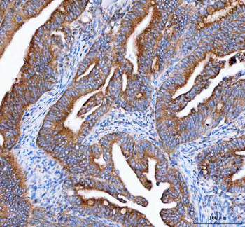 IDH3G Antibody
