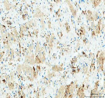 IDH3G Antibody